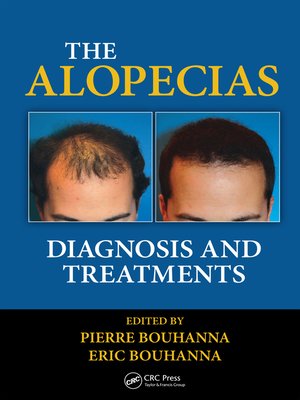 cover image of The Alopecias
